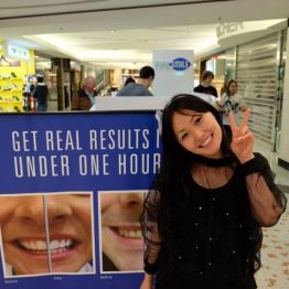 Teeth Whitening - Kouture Kitty posing next to before and after tarpaulin