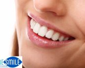 home remedies to whiten teeth Pure Smile