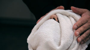 Skin Rejuvenation - Warm Towel