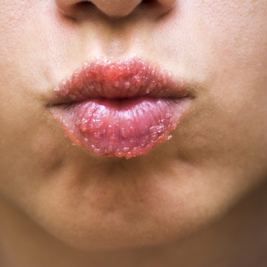 Exfoliate lips