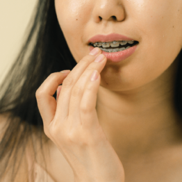 woman with braces touching her lips