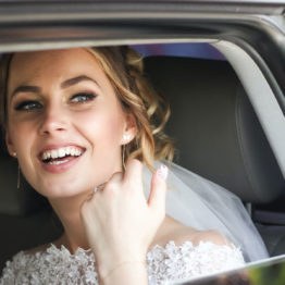 How to Have Whiter Teeth for Your Wedding Day