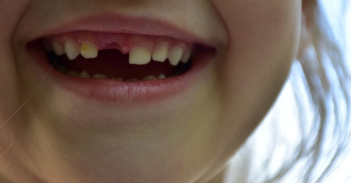 Should You Preserve Your Kids’ Baby Teeth? PureSmile