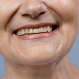 aging yellow teeth