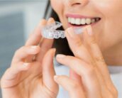Clear Aligner Turning Yellow
