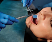 peroxide free teeth whitening